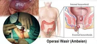 Jual Ambejos Salep Salwa Herbal Denature Di Pagar Alam