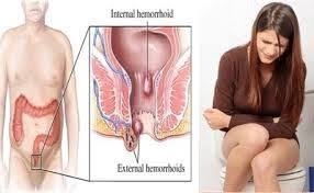 Jual Ambejos Salep Salwa Herbal Denature Di Kendari