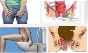 Jual Ambejos Salep Salwa Herbal Denature Di Palembang